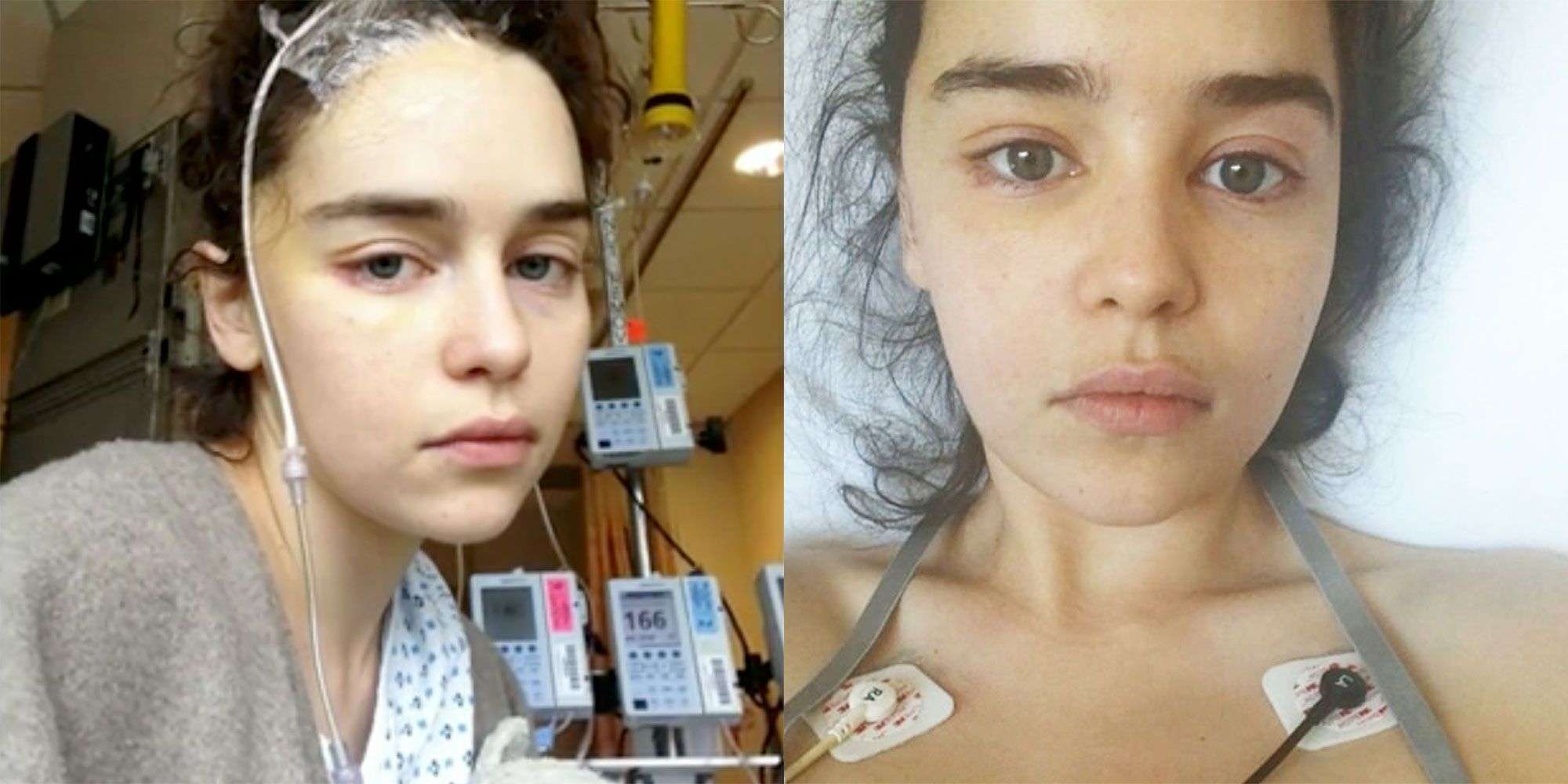 Emilia Clarke: le foto condivise dall’attrice della sua operazione al cervello
